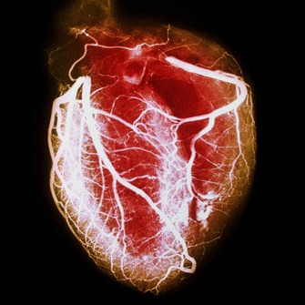 What Your Doctor May Not Tell Y ou About Heart Disease