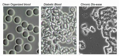 Live Blood Cell Analysis and Prodovite